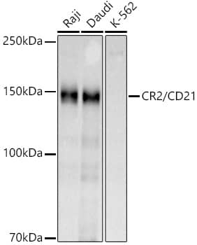 Western Blot: CD21 Antibody [NBP3-38538] - Western blot analysis of various lysates using CD21 Rabbit pAb at 1:1000 dilution.Secondary antibody: HRP-conjugated Goat anti-Rabbit IgG (H+L) at 1:10000 dilution.Lysates/proteins: 25ug per lane.Blocking buffer: 3% nonfat dry milk in TBST.Detection: ECL Basic Kit.Exposure time: 60s.