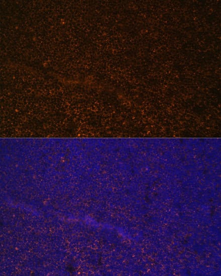 Immunocytochemistry/ Immunofluorescence: CD21 Antibody [NBP3-38538] - Immunofluorescence analysis of paraffin-embedded mouse spleen using CD21 Rabbit pAb at dilution of 1:100 (40x lens). Secondary antibody: Cy3-conjugated Goat anti-Rabbit IgG (H+L) at 1:500 dilution. Blue: DAPI for nuclear staining.