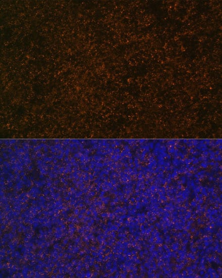 Immunocytochemistry/ Immunofluorescence: CD21 Antibody [NBP3-38538] - Immunofluorescence analysis of paraffin-embedded rat spleen using CD21 Rabbit pAb at dilution of 1:100 (40x lens). Secondary antibody: Cy3-conjugated Goat anti-Rabbit IgG (H+L) at 1:500 dilution. Blue: DAPI for nuclear staining.