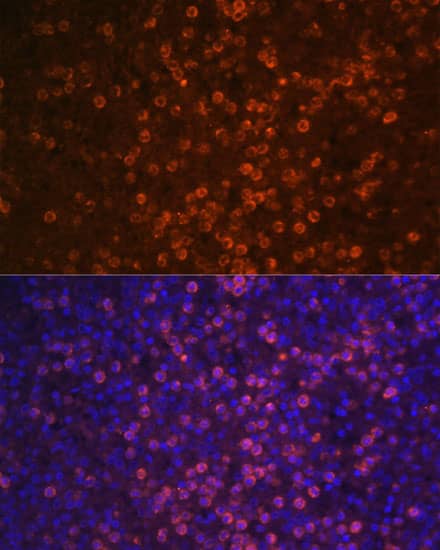 Immunocytochemistry/ Immunofluorescence: CD21 Antibody [NBP3-38538] - Immunofluorescence analysis of paraffin-embedded human spleen using CD21 Rabbit pAb at dilution of 1:100 (40x lens). Secondary antibody: Cy3-conjugated Goat anti-Rabbit IgG (H+L) at 1:500 dilution. Blue: DAPI for nuclear staining.