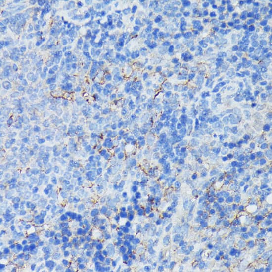 Immunohistochemistry: CD21 Antibody [NBP3-38538] - Immunohistochemistry analysis of paraffin-embedded Rat spleen using CD21 Rabbit pAb at dilution of 1:100 (40x lens). Microwave antigen retrieval performed with 0.01M PBS Buffer (pH 7.2) prior to IHC staining.