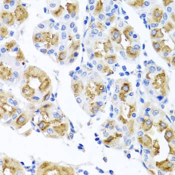 Immunohistochemistry: FECH Antibody [NBP3-38540] - Immunohistochemistry analysis of paraffin-embedded Human stomach using FECH Rabbit pAb at dilution of 1:100 (40x lens). Microwave antigen retrieval performed with 0.01M PBS Buffer (pH 7.2) prior to IHC staining.