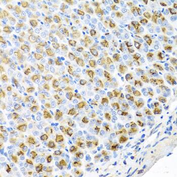 Immunohistochemistry: FECH Antibody [NBP3-38540] - Immunohistochemistry analysis of paraffin-embedded Mouse stomach using FECH Rabbit pAb at dilution of 1:100 (40x lens). Microwave antigen retrieval performed with 0.01M PBS Buffer (pH 7.2) prior to IHC staining.