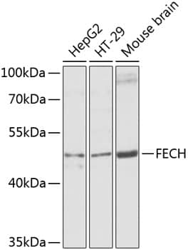 Western Blot: FECH Antibody [NBP3-38540] - Western blot analysis of various lysates using FECH Rabbit pAb at 1:1000 dilution.Secondary antibody: HRP-conjugated Goat anti-Rabbit IgG (H+L) at 1:10000 dilution.Lysates/proteins: 25ug per lane.Blocking buffer: 3% nonfat dry milk in TBST.Detection: ECL Basic Kit.Exposure time: 5s.