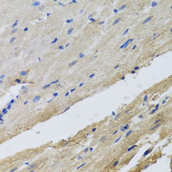 Immunohistochemistry: FECH Antibody [NBP3-38540] - Immunohistochemistry analysis of paraffin-embedded Rat heart using FECH Rabbit pAb at dilution of 1:100 (40x lens). Microwave antigen retrieval performed with 0.01M PBS Buffer (pH 7.2) prior to IHC staining.