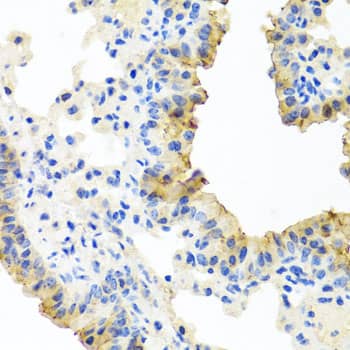 Immunohistochemistry: FECH Antibody [NBP3-38540] - Immunohistochemistry analysis of paraffin-embedded Mouse lung using FECH Rabbit pAb at dilution of 1:100 (40x lens). Microwave antigen retrieval performed with 0.01M PBS Buffer (pH 7.2) prior to IHC staining.