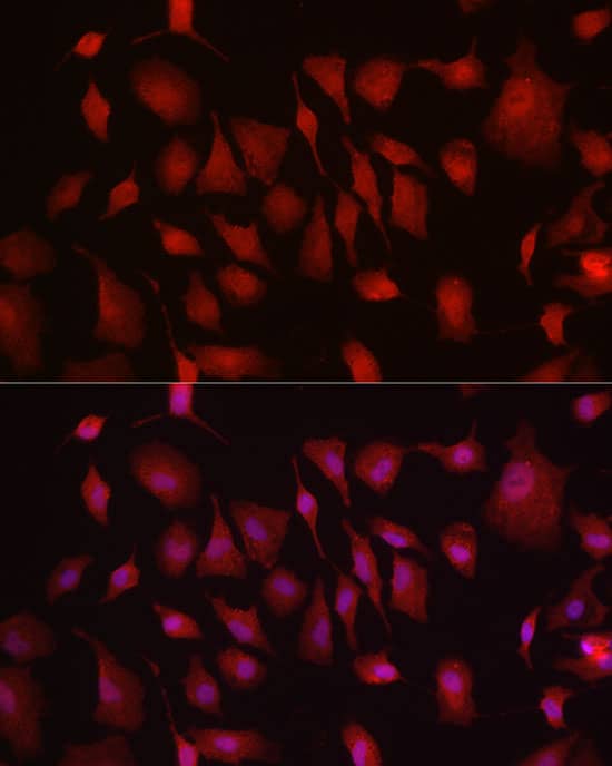 Immunocytochemistry/ Immunofluorescence Hexokinase Type III Antibody