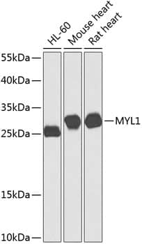 Western Blot: Fast skeletal myosin light chain 1 Antibody [NBP3-38544] - Western blot analysis of various lysates using Fast skeletal myosin light chain 1 Rabbit pAb at 1:1000 dilution.Secondary antibody: HRP-conjugated Goat anti-Rabbit IgG (H+L) at 1:10000 dilution.Lysates/proteins: 25ug per lane.Blocking buffer: 3% nonfat dry milk in TBST.Detection: ECL Basic Kit.Exposure time: 60s.