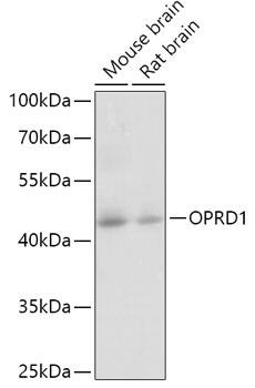 Western Blot: delta Opioid R/OPRD1 Antibody [NBP3-38545] - Western blot analysis of various lysates using delta Opioid R/OPRD1 Rabbit pAb at 1:1000 dilution.Secondary antibody: HRP-conjugated Goat anti-Rabbit IgG (H+L) at 1:10000 dilution.Lysates/proteins: 25ug per lane.Blocking buffer: 3% nonfat dry milk in TBST.Detection: ECL Basic Kit.Exposure time: 5s.