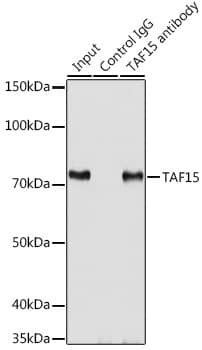 Immunoprecipitation: TAF15 Antibody [NBP3-38548] - Immunoprecipitation analysis of 200 ug extracts of SKOV3 cells using 3 ug TAF15 antibody. Western blot was performed from the immunoprecipitate using TAF15 antibody at a dilution of 1:1000.