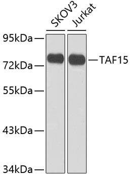 Western Blot: TAF15 Antibody [NBP3-38548] - Western blot analysis of various lysates using TAF15 Rabbit pAb at 1:1000 dilution.Secondary antibody: HRP-conjugated Goat anti-Rabbit IgG (H+L) at 1:10000 dilution.Lysates/proteins: 25ug per lane.Blocking buffer: 3% nonfat dry milk in TBST.Detection: ECL Enhanced Kit.Exposure time: 5s.