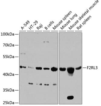 Western Blot: PAR4 Antibody [NBP3-38550] - Western blot analysis of various lysates using PAR4 Rabbit pAb at 1:1000 dilution.Secondary antibody: HRP-conjugated Goat anti-Rabbit IgG (H+L) at 1:10000 dilution.Lysates/proteins: 25ug per lane.Blocking buffer: 3% nonfat dry milk in TBST.Detection: ECL Basic Kit.Exposure time: 90s.