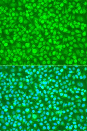 Immunocytochemistry/ Immunofluorescence: N4BP1 Antibody [NBP3-38551] - Immunofluorescence analysis of U2OS cells using N4BP1 Rabbit pAb at dilution of 1:100. Secondary antibody: Cy3-conjugated Goat anti-Rabbit IgG (H+L) at 1:500 dilution. Blue: DAPI for nuclear staining.