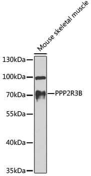 Western Blot: PR48 Antibody [NBP3-38554] - Western blot analysis of lysates from mouse skeletal muscle, using PR48 Rabbit pAb at 1:1000 dilution.Secondary antibody: HRP-conjugated Goat anti-Rabbit IgG (H+L) at 1:10000 dilution.Lysates/proteins: 25ug per lane.Blocking buffer: 3% nonfat dry milk in TBST.Detection: ECL Basic Kit.Exposure time: 30s.