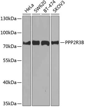 Western Blot: PR48 Antibody [NBP3-38554] - Western blot analysis of various lysates using PR48 Rabbit pAb at 1:1000 dilution.Secondary antibody: HRP-conjugated Goat anti-Rabbit IgG (H+L) at 1:10000 dilution.Lysates/proteins: 25ug per lane.Blocking buffer: 3% nonfat dry milk in TBST.Detection: ECL Enhanced Kit.Exposure time: 30s.