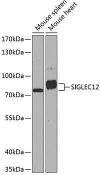 Western Blot: SIGLECL12 Antibody [NBP3-38557] - Western blot analysis of various lysates using SIGLECL12 Rabbit pAb at 1:1000 dilution.Secondary antibody: HRP-conjugated Goat anti-Rabbit IgG (H+L) at 1:10000 dilution.Lysates/proteins: 25ug per lane.Blocking buffer: 3% nonfat dry milk in TBST.Detection: ECL Basic Kit.Exposure time: 90s.