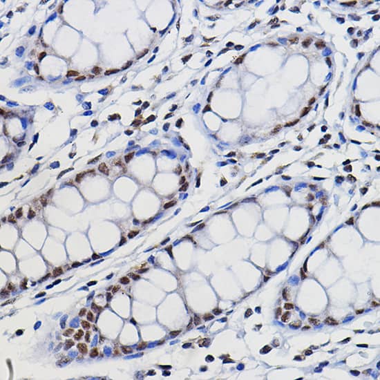 Immunohistochemistry: METTL14 Antibody [NBP3-38559] - Immunohistochemistry analysis of paraffin-embedded Human colon using METTL14 Rabbit pAb at dilution of 1:100 (40x lens). High pressure antigen retrieval performed with 0.01M Citrate Bufferr (pH 6.0) prior to IHC staining.