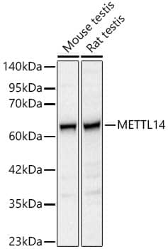Western Blot: METTL14 Antibody [NBP3-38559] - Western blot analysis of various lysates, using METTL14 Rabbit pAb at 1:500 dilution.Secondary antibody: HRP-conjugated Goat anti-Rabbit IgG (H+L) at 1:10000 dilution.Lysates/proteins: 25ug per lane.Blocking buffer: 3% nonfat dry milk in TBST.Detection: ECL Basic Kit.Exposure time: 5s.