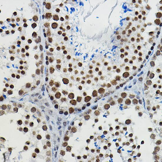 Immunohistochemistry: METTL14 Antibody [NBP3-38559] - Immunohistochemistry analysis of paraffin-embedded Mouse testis using METTL14 Rabbit pAb at dilution of 1:100 (40x lens). High pressure antigen retrieval performed with 0.01M Citrate Bufferr (pH 6.0) prior to IHC staining.