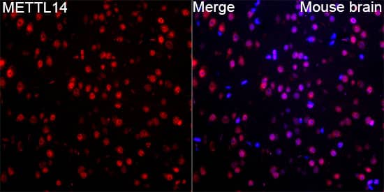 Immunocytochemistry/ Immunofluorescence: METTL14 Antibody [NBP3-38559] - Immunofluorescence analysis of Mouse brain tissue using METTL14 Rabbit pAb at a dilution of 1:100 (40x lens). Secondary antibody: Cy3-conjugated Goat anti-Rabbit IgG (H+L)at 1:500 dilution. Blue: DAPI for nuclear staining. Microwave antigen retrieval performed with 0.01M Citrate Buffer (pH 6.0) prior to IF staining.