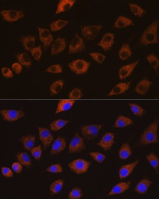 Immunocytochemistry/ Immunofluorescence: DLG1 Antibody [NBP3-38560] - Immunofluorescence analysis of L929 cells using DLG1 Rabbit pAb at dilution of 1:100 (40x lens). Secondary antibody: Cy3-conjugated Goat anti-Rabbit IgG (H+L) at 1:500 dilution. Blue: DAPI for nuclear staining.