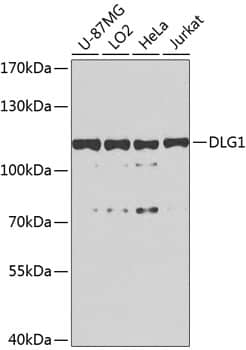 Western Blot: DLG1 Antibody [NBP3-38560] - Western blot analysis of various lysates using DLG1 Rabbit pAb at 1:1000 dilution.Secondary antibody: HRP-conjugated Goat anti-Rabbit IgG (H+L) at 1:10000 dilution.Lysates/proteins: 25ug per lane.Blocking buffer: 3% nonfat dry milk in TBST.Detection: ECL Basic Kit.Exposure time: 90s.