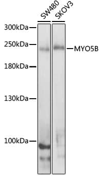 Western Blot: Myosin VB Antibody [NBP3-38561] - Western blot analysis of various lysates using Myosin VB Rabbit pAb at 1:1000 dilution.Secondary antibody: HRP-conjugated Goat anti-Rabbit IgG (H+L) at 1:10000 dilution.Lysates/proteins: 25ug per lane.Blocking buffer: 3% nonfat dry milk in TBST.Detection: ECL Enhanced Kit.Exposure time: 30s.