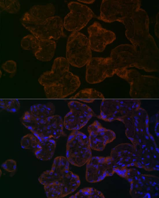 Immunocytochemistry/ Immunofluorescence: Myosin VB Antibody [NBP3-38561] - Immunofluorescence analysis of paraffin-embedded Human placenta using Myosin VB Rabbit pAb at dilution of 1:100. Secondary antibody: Cy3-conjugated Goat anti-Rabbit IgG (H+L) at 1:500 dilution. Blue: DAPI for nuclear staining.