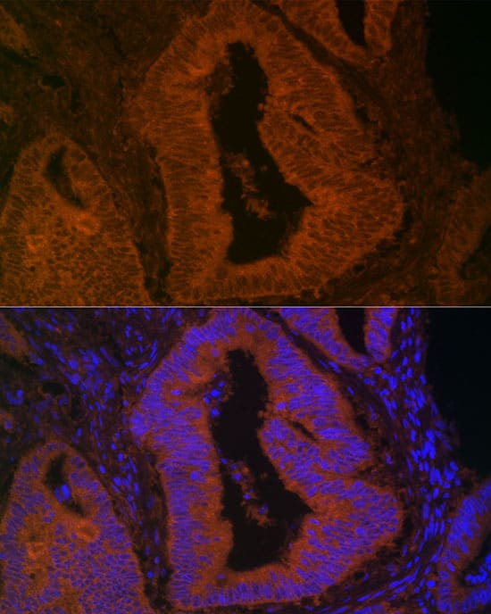 Immunocytochemistry/ Immunofluorescence Myosin VB Antibody