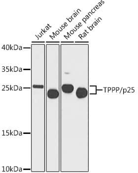 Western Blot: TPPP/p25 Antibody [NBP3-38563] - Western blot analysis of various lysates using TPPP/p25 Rabbit pAb at 1:1000 dilution.Secondary antibody: HRP-conjugated Goat anti-Rabbit IgG (H+L) at 1:10000 dilution.Lysates/proteins: 25ug per lane.Blocking buffer: 3% nonfat dry milk in TBST.Detection: ECL Basic Kit.Exposure time: 30s.