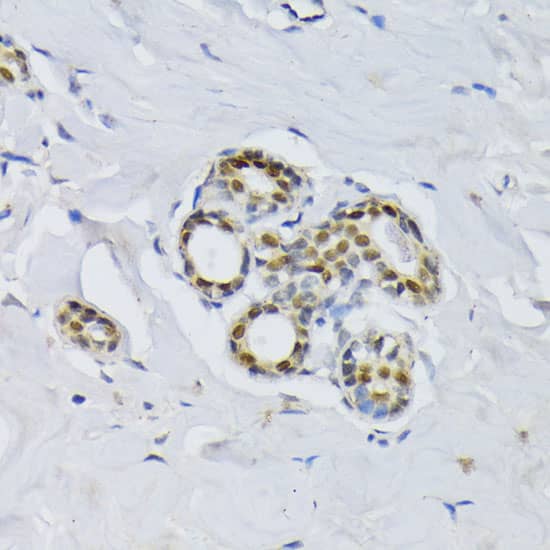 Immunohistochemistry: BCCIP Antibody [NBP3-38567] - Immunohistochemistry analysis of paraffin-embedded Human breast using BCCIP Rabbit pAb at dilution of 1:100 (40x lens). Microwave antigen retrieval performed with 0.01M PBS Buffer (pH 7.2) prior to IHC staining.