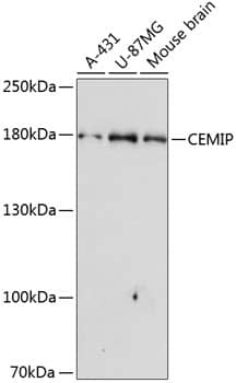 Western Blot: CEMIP/KIAA1199 Antibody [NBP3-38568] - Western blot analysis of various lysates using CEMIP/KIAA1199 Rabbit pAb at 1:3000 dilution.Secondary antibody: HRP-conjugated Goat anti-Rabbit IgG (H+L) at 1:10000 dilution.Lysates/proteins: 25ug per lane.Blocking buffer: 3% nonfat dry milk in TBST.Detection: ECL Enhanced Kit.Exposure time: 90s.
