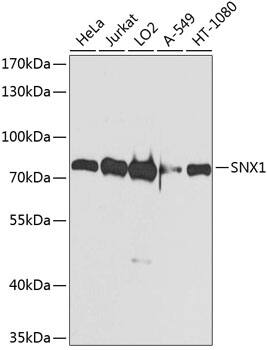 Western Blot: SNX1 Antibody [NBP3-38570] - Western blot analysis of various lysates using SNX1 Rabbit pAb at 1:1000 dilution.Secondary antibody: HRP-conjugated Goat anti-Rabbit IgG (H+L) at 1:10000 dilution.Lysates/proteins: 25ug per lane.Blocking buffer: 3% nonfat dry milk in TBST.Detection: ECL Basic Kit.Exposure time: 1s.