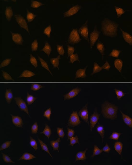 Immunocytochemistry/ Immunofluorescence: SNX1 Antibody [NBP3-38570] - Immunofluorescence analysis of L929 cells using SNX1 Rabbit pAb at dilution of 100 (40x lens). Secondary antibody: Cy3-conjugated Goat anti-Rabbit IgG (H+L) at 1:500 dilution. Blue: DAPI for nuclear staining.