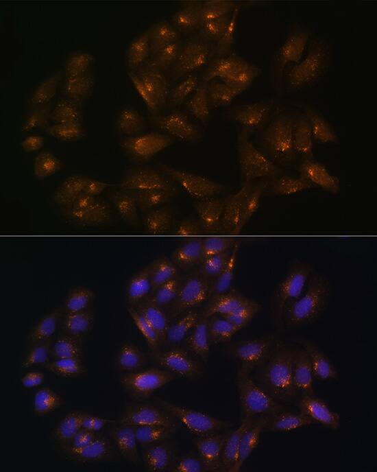 Immunocytochemistry/ Immunofluorescence: SNX1 Antibody [NBP3-38570] - Immunofluorescence analysis of U-2 OS cells using SNX1 Rabbit pAb at dilution of 100 (40x lens). Secondary antibody: Cy3-conjugated Goat anti-Rabbit IgG (H+L) at 1:500 dilution. Blue: DAPI for nuclear staining.