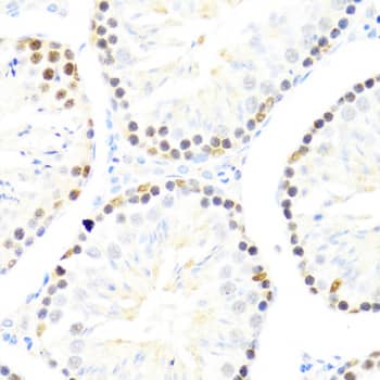 Immunohistochemistry DDX50 Antibody