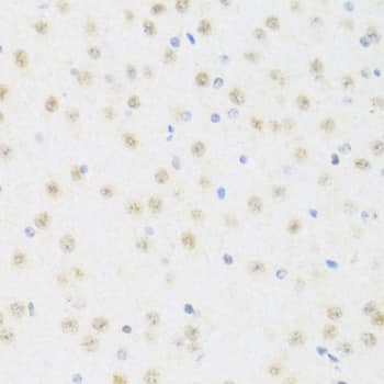 Immunohistochemistry: DDX50 Antibody [NBP3-38571] - Immunohistochemistry analysis of paraffin-embedded Mouse brain using DDX50 Rabbit pAb at dilution of 1:100 (40x lens). Microwave antigen retrieval performed with 0.01M PBS Buffer (pH 7.2) prior to IHC staining.