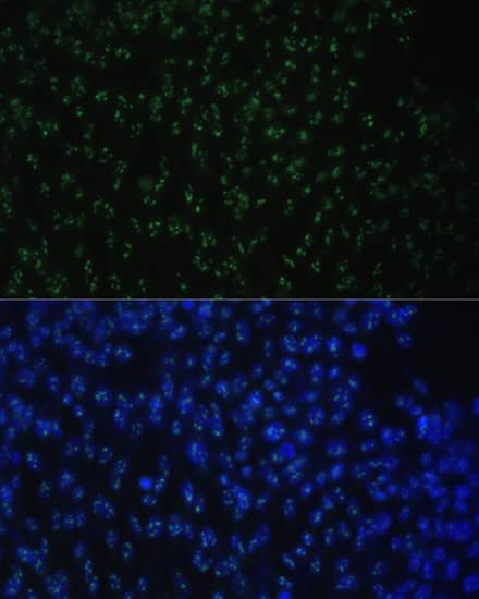 Immunocytochemistry/ Immunofluorescence DDX50 Antibody