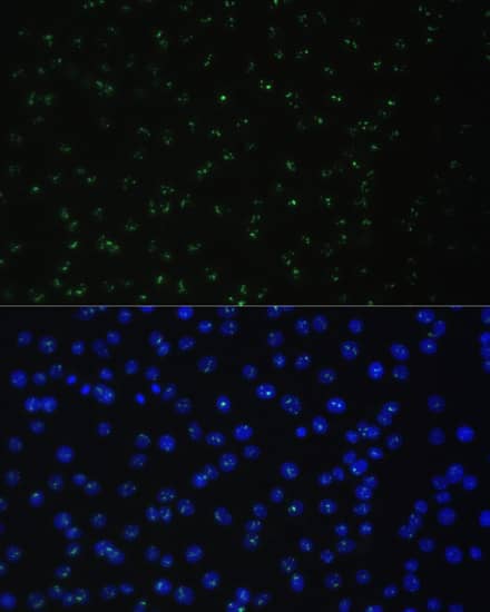 Immunocytochemistry/ Immunofluorescence DDX50 Antibody