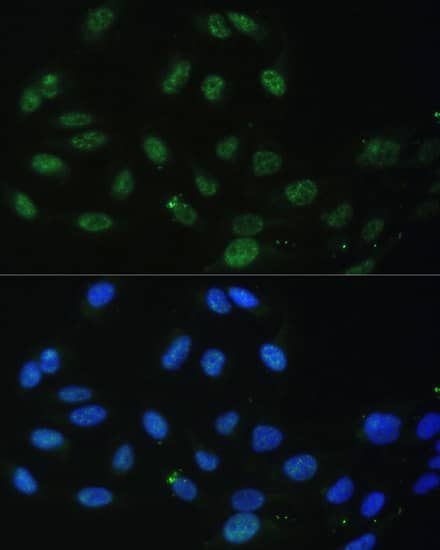 Immunocytochemistry/ Immunofluorescence: DDX50 Antibody [NBP3-38571] - Immunofluorescence analysis of U-2 OS cells using DDX50 Rabbit pAb at dilution of 1:100. Secondary antibody: Cy3-conjugated Goat anti-Rabbit IgG (H+L) at 1:500 dilution. Blue: DAPI for nuclear staining.