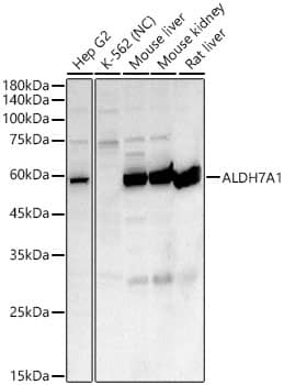 Western Blot: ALDH7A1 Antibody [NBP3-38572] - Western blot analysis of various lysates, using ALDH7A1 Rabbit pAb at 1:400 dilution.Secondary antibody: HRP-conjugated Goat anti-Rabbit IgG (H+L) at 1:10000 dilution.Lysates/proteins: 25ug per lane.Blocking buffer: 3% nonfat dry milk in TBST.Detection: ECL Enhanced Kit.Negative control (NC): K-562.Exposure time: 75s.