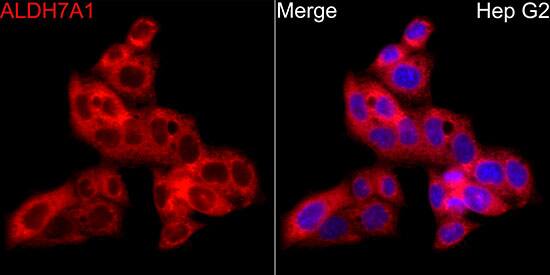 Immunohistochemistry: ALDH7A1 Antibody [NBP3-38572] - Immunohistochemistry analysis of paraffin-embedded Human kidney tissue using ALDH7A1 Rabbit pAb at a dilution of 1:50 (40x lens). High pressure antigen retrieval performed with 0.01M Citrate Bufferr (pH 6.0) prior to IHC staining.