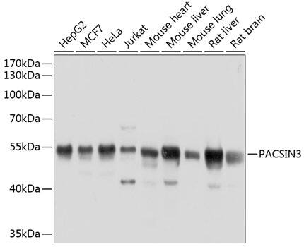 Western Blot: PACSIN3 Antibody [NBP3-38573] - Western blot analysis of various lysates using PACSIN3 Rabbit pAb at 1:1000 dilution.Secondary antibody: HRP-conjugated Goat anti-Rabbit IgG (H+L) at 1:10000 dilution.Lysates/proteins: 25ug per lane.Blocking buffer: 3% nonfat dry milk in TBST.Detection: ECL Basic Kit.Exposure time: 1s.