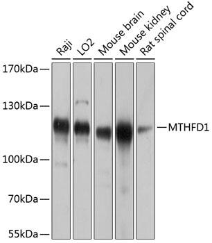 Western Blot: MTHFD1 Antibody [NBP3-38574] - Western blot analysis of various lysates using MTHFD1 Rabbit pAb at 1:1000 dilution.Secondary antibody: HRP-conjugated Goat anti-Rabbit IgG (H+L) at 1:10000 dilution.Lysates/proteins: 25ug per lane.Blocking buffer: 3% nonfat dry milk in TBST.Detection: ECL Basic Kit.Exposure time: 5s.