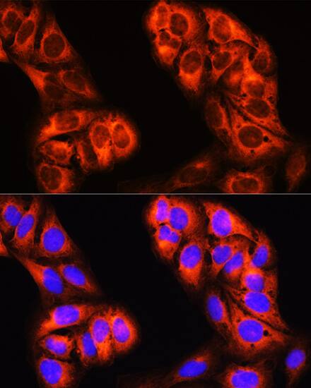 Immunocytochemistry/ Immunofluorescence: MTHFD1 Antibody [NBP3-38574] - Immunofluorescence analysis of U-2 OS cells using MTHFD1 Rabbit pAb at dilution of 1:100 (40x lens). Secondary antibody: Cy3-conjugated Goat anti-Rabbit IgG (H+L) at 1:500 dilution. Blue: DAPI for nuclear staining.