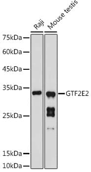 Western Blot: TFIIE beta Antibody [NBP3-38577] - Western blot analysis of various lysates using TFIIE beta Rabbit pAb at 1:1000 dilution.Secondary antibody: HRP-conjugated Goat anti-Rabbit IgG (H+L) at 1:10000 dilution.Lysates/proteins: 25ug per lane.Blocking buffer: 3% nonfat dry milk in TBST.Detection: ECL Basic Kit.Exposure time: 180s.