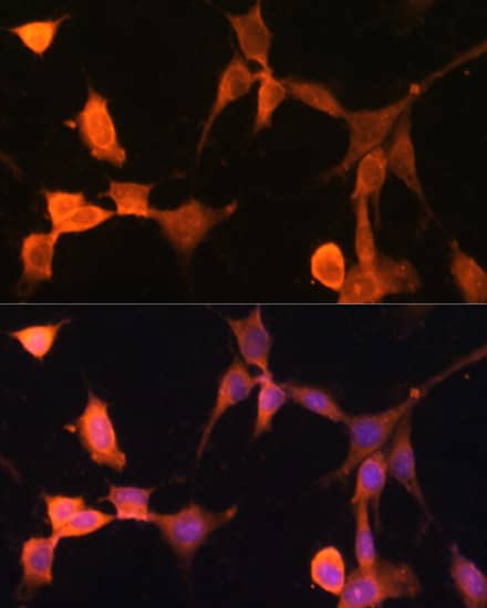 Immunocytochemistry/ Immunofluorescence: CACYBP Antibody [NBP3-38578] - Immunofluorescence analysis of NIH-3T3 cells using [KO Validated] CACYBP Rabbit pAb at dilution of 1:100. Secondary antibody: Cy3-conjugated Goat anti-Rabbit IgG (H+L) at 1:500 dilution. Blue: DAPI for nuclear staining.