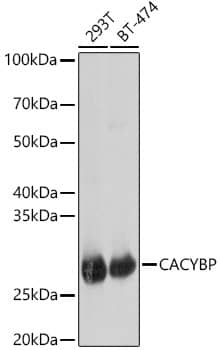 Western Blot: CACYBP Antibody [NBP3-38578] - Western blot analysis of various lysates, using [KO Validated] CACYBP Rabbit pAb at 1:1000 dilution.Secondary antibody: HRP-conjugated Goat anti-Rabbit IgG (H+L) at 1:10000 dilution.Lysates/proteins: 25ug per lane.Blocking buffer: 3% nonfat dry milk in TBST.Detection: ECL Basic Kit.Exposure time: 1s.