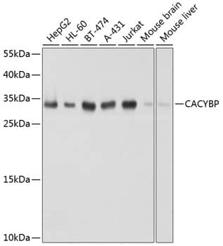 Western Blot: CACYBP Antibody [NBP3-38578] - Western blot analysis of various lysates using [KO Validated] CACYBP Rabbit pAb at 1:1000 dilution.Secondary antibody: HRP-conjugated Goat anti-Rabbit IgG (H+L) at 1:10000 dilution.Lysates/proteins: 25ug per lane.Blocking buffer: 3% nonfat dry milk in TBST.Detection: ECL Basic Kit.Exposure time: 1s.