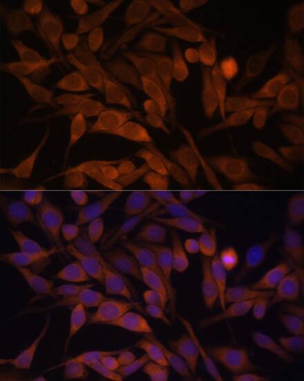 Immunocytochemistry/ Immunofluorescence CACYBP Antibody